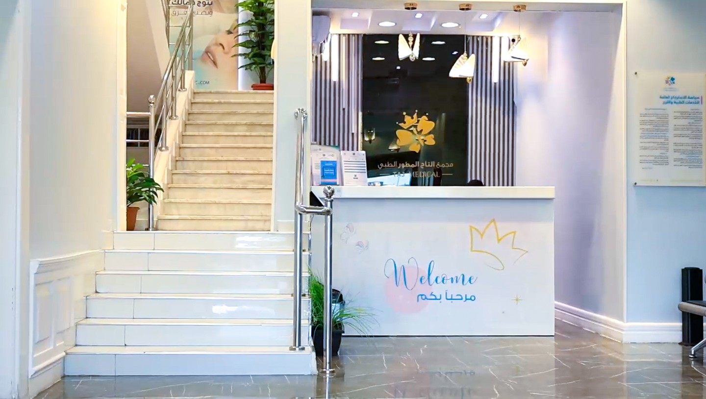 صورة العنصر